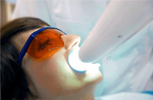 Understanding the Causes of Teeth Sensitivity Nuneaton