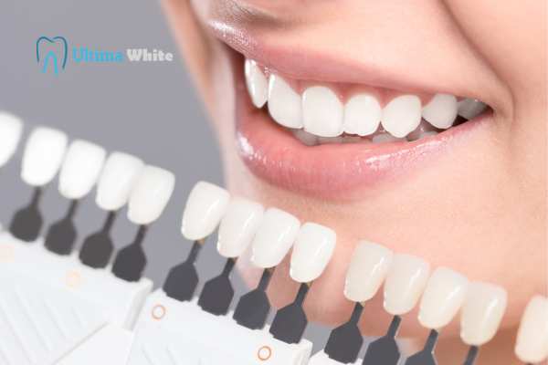 How to Maximise the Results of Your Laser Teeth Whitening Treatment Nuneaton
