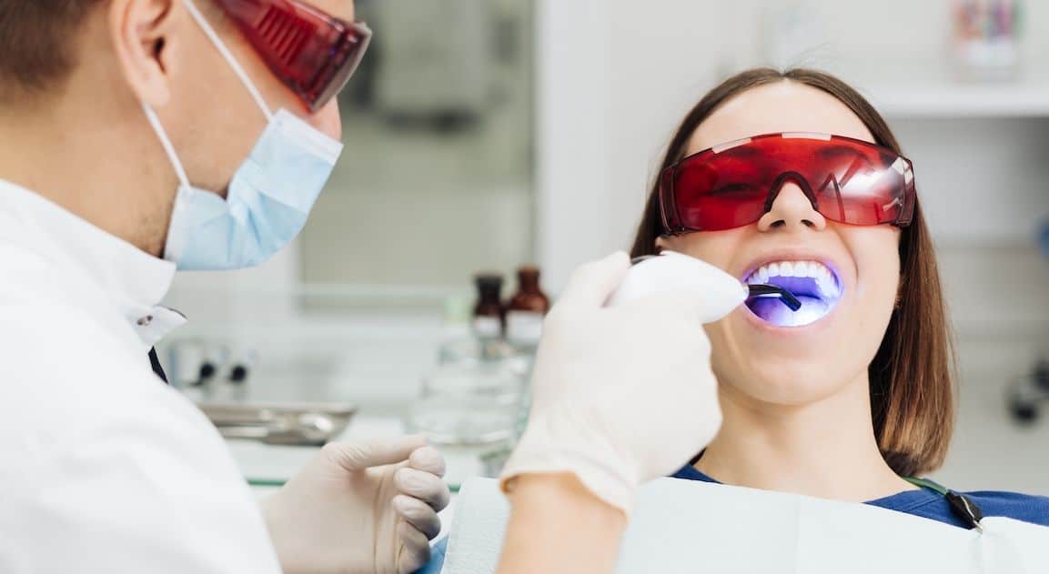 Do Dental Crowns Change Colour After Teeth Whitening Nuneaton?