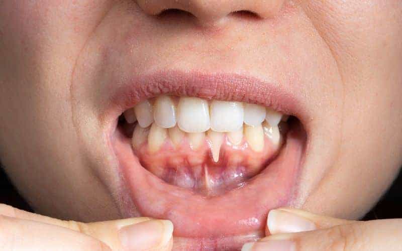 Final Thoughts: Building Lifelong Enamel Protection Habits Nuneaton