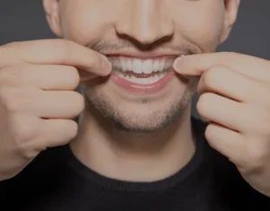 Overview of Home Teeth Whitening Kits Nuneaton