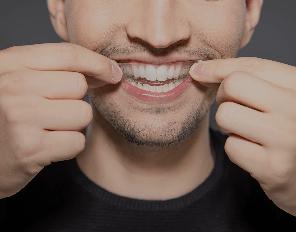 How Are Invisible Aligners Changing Orthodontic Treatments Nuneaton?
