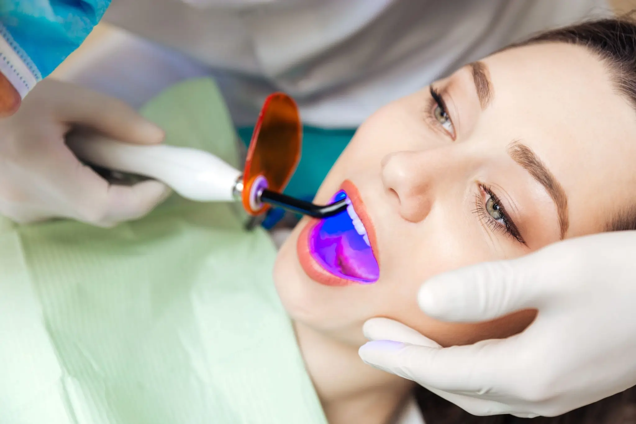 How Can You Protect Your Smile After Laser Whitening Nuneaton?