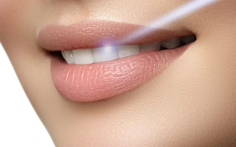 Understanding Teeth Whitening Risks and Results Nuneaton