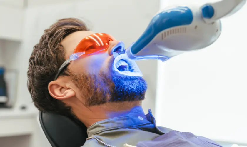 Can Professional Laser Teeth Whitening Like Ultima White Be Safe for Sensitive Teeth Nuneaton?