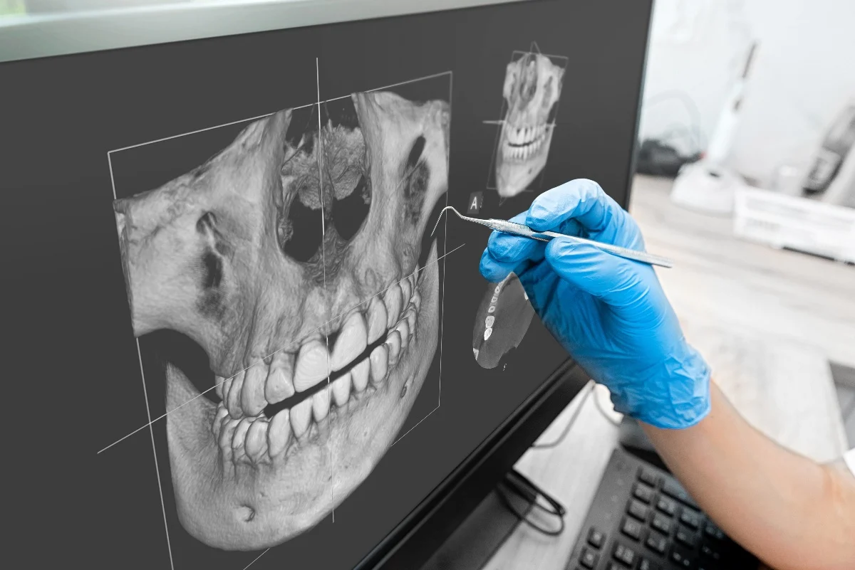 Key Benefits of 3D Printing for Patients and Dentists Nuneaton