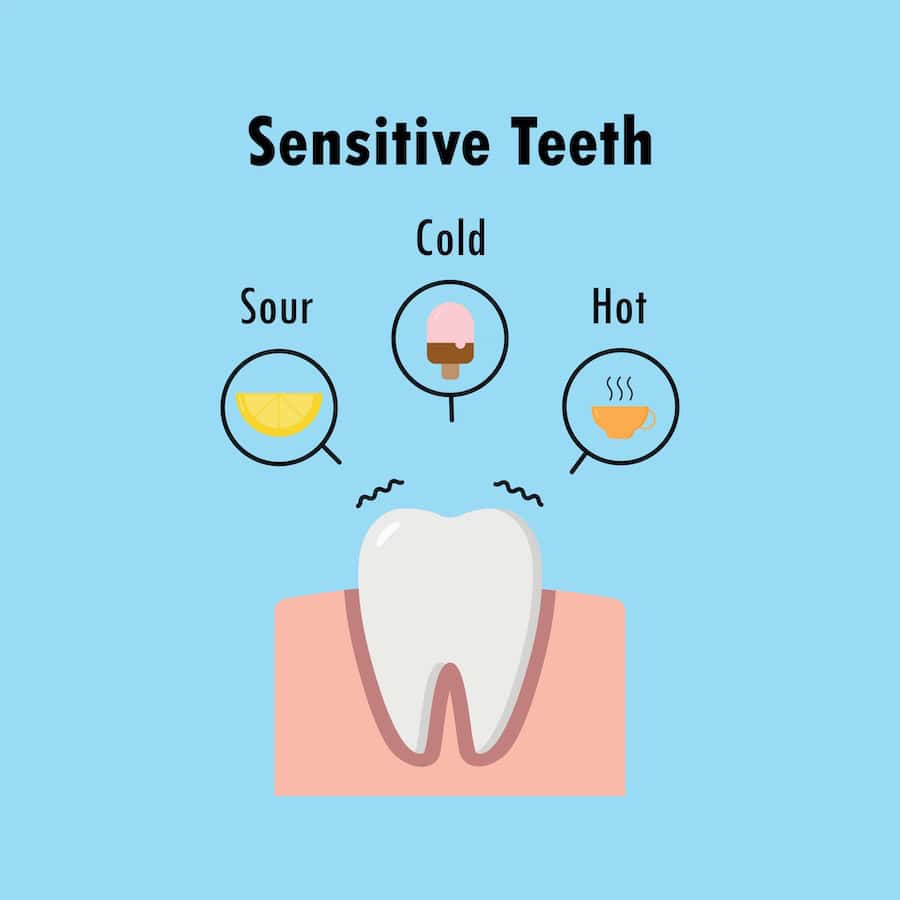 How Can You Tell If Your Teeth Are Becoming Sensitive Nuneaton?