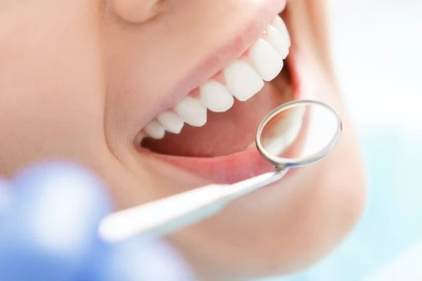 How Do You Choose the Right Cosmetic Dentist Nuneaton?