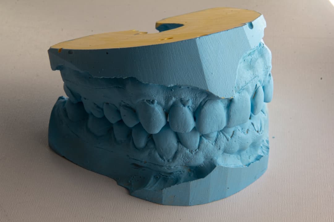 How Do Dental Implants Improve Jawbone Health and Oral Function Nuneaton?