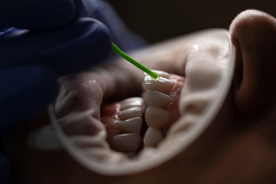The Role of Saliva: Nature’s Defense System Nuneaton