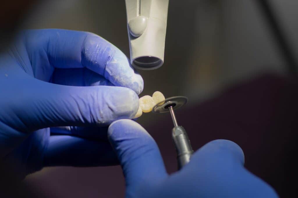 Customised Dental Solutions: Crowns, Aligners, and Implants Nuneaton