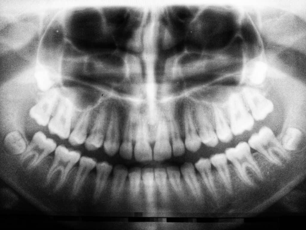 The Future of 3D Printing in Oral Healthcare Nuneaton